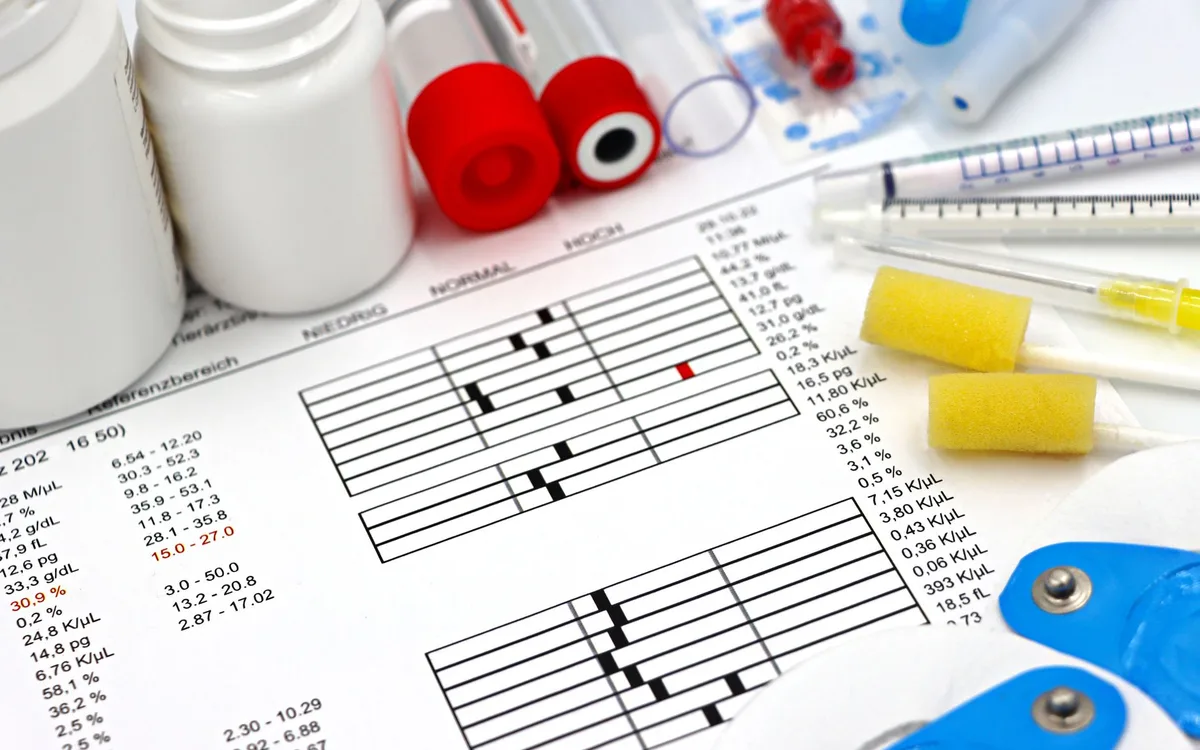 Wyniki badań krwi - odbiór, czas oczekiwania i interpretacja